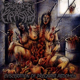 Suicide Of Disaster “Evisceration Of Pregnant Abdomen”